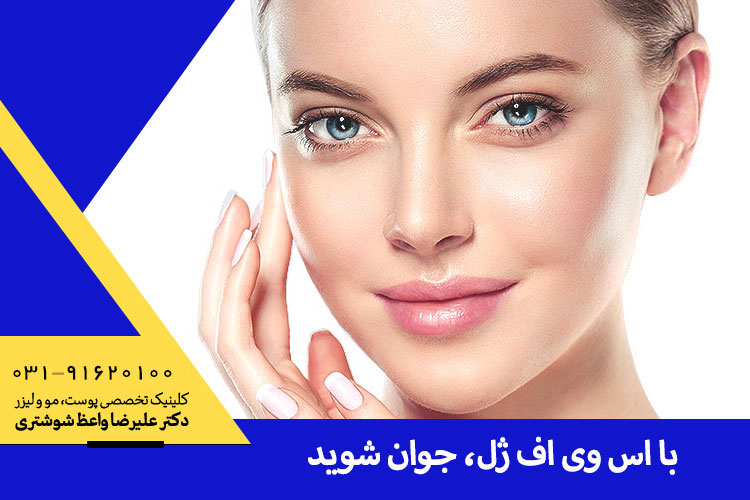 تزریق اس وی اف ژل در کلینیک دکتر واعظ شوشتری