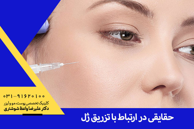 تزریق ژل در کلینیک دکتر واعظ شوشتری