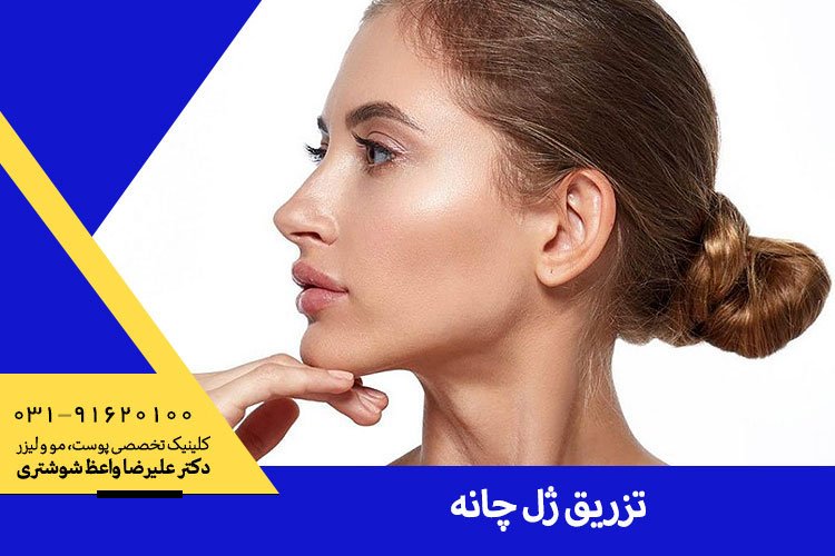 تزریق ژل چانه، دکتر واعظ شوشتری